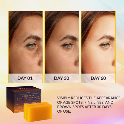 VALITIC VALITIC Kojic Acid Dark Spot Remover Soap Bars – Vitamin C, Retinol, Collagen & Turmeric Soap with Hyaluronic Acid, Shea Butter & Olive Oil for Brighter Skin, 2-Pack
