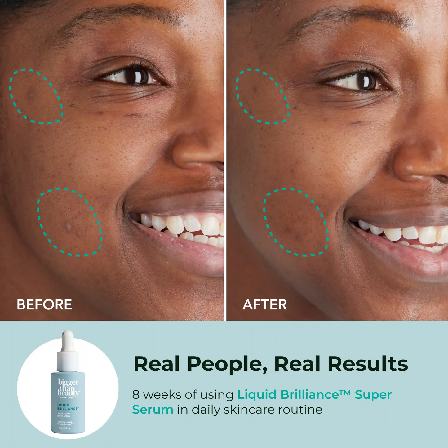 Liquid Brilliance™ Super Serum