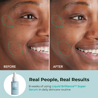 Liquid Brilliance™ Super Serum