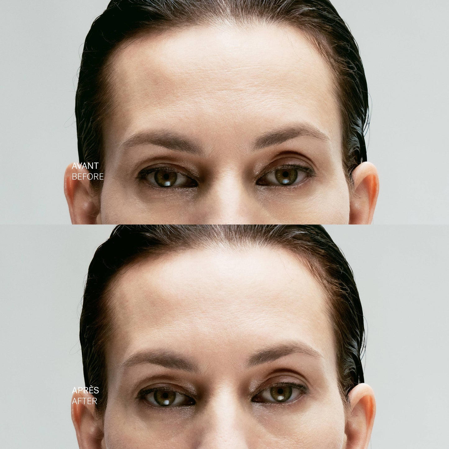 A43 Firming Concentrate – Peptide Complex & Hyaluronic Acid Skin Tightening Serum for Smoother, Firmer-Looking Skin, 15 mL