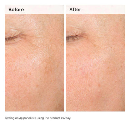 The Ordinary  Alpha Arbutin 2% + HA Hyperpigmentation Serum