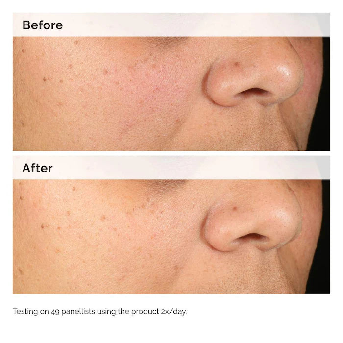 The Ordinary  Alpha Arbutin 2% + HA Hyperpigmentation Serum