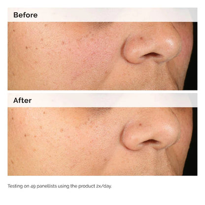 The Ordinary  Alpha Arbutin 2% + HA Hyperpigmentation Serum