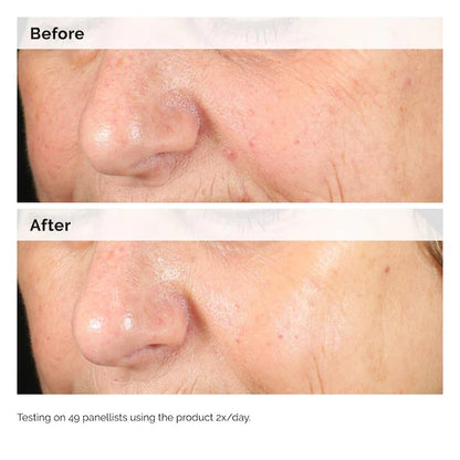 The Ordinary  Alpha Arbutin 2% + HA Hyperpigmentation Serum