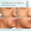 INNBEAUTY PROJECT INNBEAUTY PROJECT Green Machine Serum – Vitamin C Face Serum for Dark Spots, Uneven Tone & Hyperpigmentation Correction