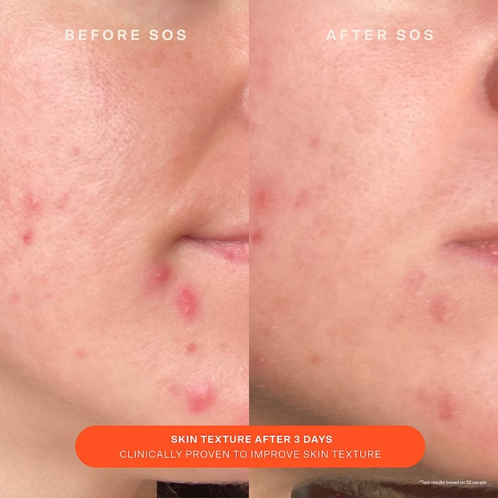 Tower 28 Beauty  SOS Daily Skin Barrier Redness Recovery Moisturizer