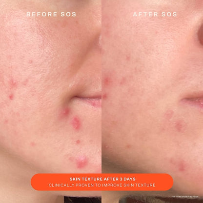 Tower 28 Beauty  SOS Daily Skin Barrier Redness Recovery Moisturizer