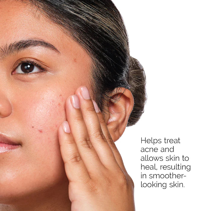 The Ordinary  The Acne Set