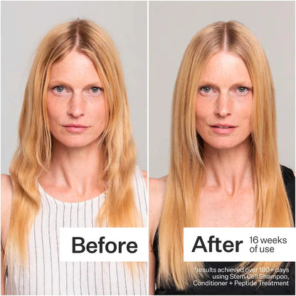 Act+Acre  Stem Cell Shampoo For Thicker+ Fuller-Looking Hair