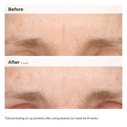 The Ordinary  Retinal 0.2% Emulsion Serum
