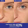 Caudalie Vinoperfect Dark Spot Correcting Serum – Brightening Vitamin C Alternative for Glowing Skin