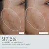 Dieux Dieux Deliverance Repair Serum – Multi-Action Serum for Redness Relief, Fine Lines & Hyperpigmentation
