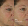 Tatcha The Dewy Skin Cream – Plumping & Hydrating Refillable Moisturizer for Glowing, Dry Skin