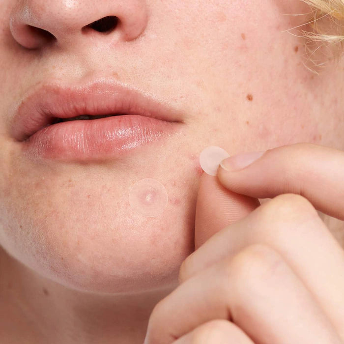 The INKEY List  Hydrocolloid Invisible Pimple Patches + Salicylic Acid