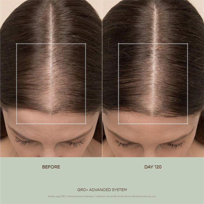 Vegamour  GRO+ Advanced Balancing Shampoo and Conditioner Set for Severe Signs of Thinning