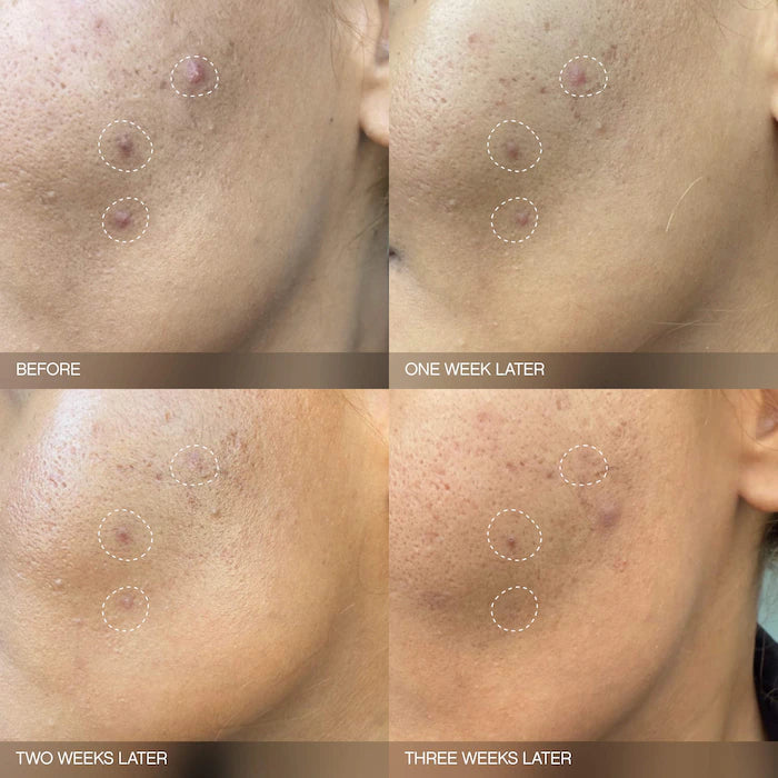 Topicals  Mini Faded Brightening and Clearing Serum for Dark Spots & Discoloration (UNSCENTED)