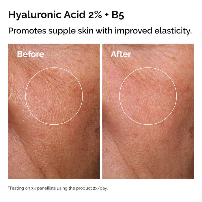 The Ordinary  The Skin Support Set with Niacinamide + Hyaluronic Acid