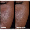 Clarins Brightening Vitamin C & AHA Glow Serum – Dark Spot & Dullness Correcting Skincare Treatment