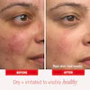 First Aid Beauty First Aid Beauty Ultra Repair® Cream – Intense Hydrating & Skin Repair Moisturizer for Face and Body
