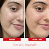 First Aid Beauty First Aid Beauty Ultra Repair Face Lotion – Soothing Daily Moisturizer for Sensitive Dry Skin with Colloidal Oatmeal